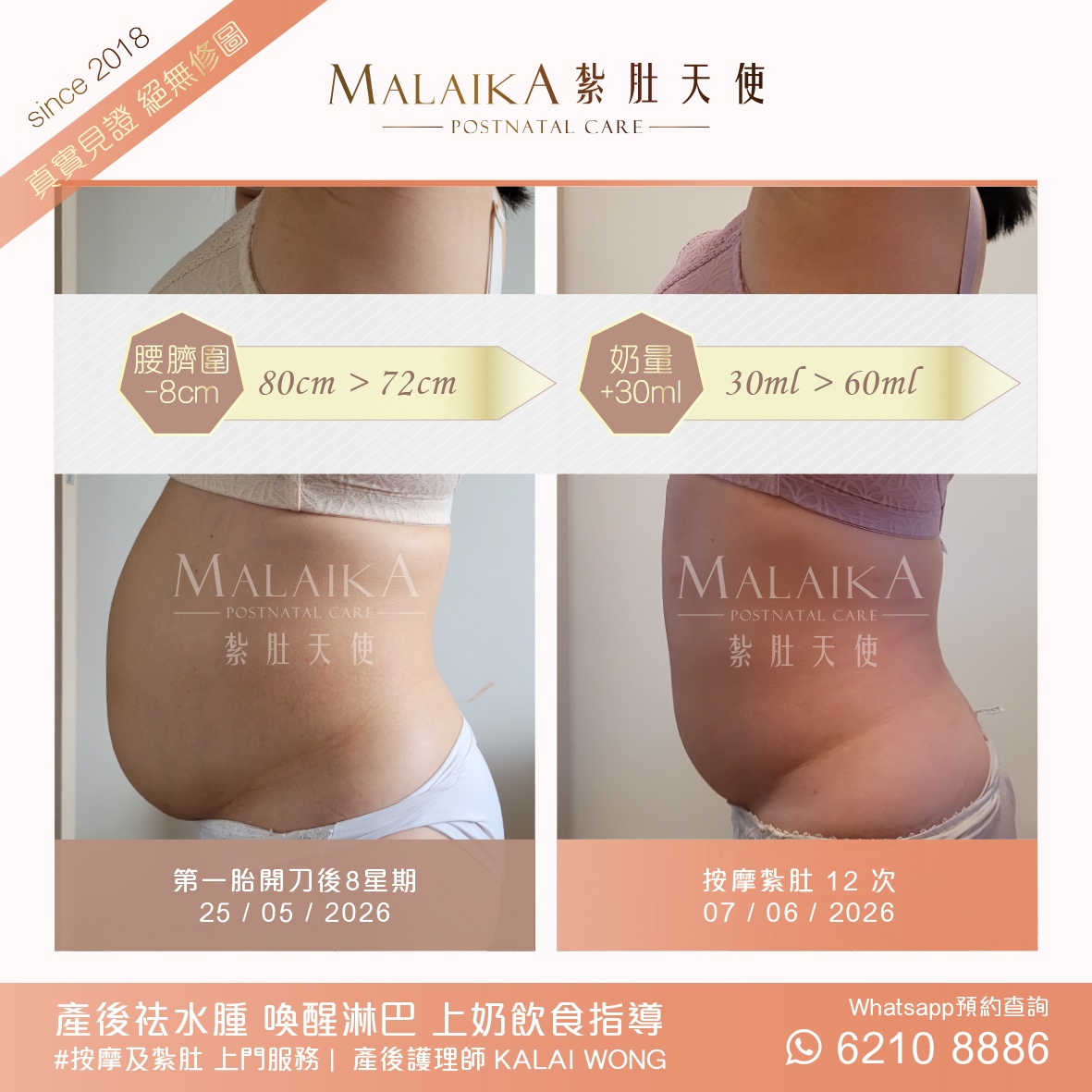 MALAIKA 紮肚天使