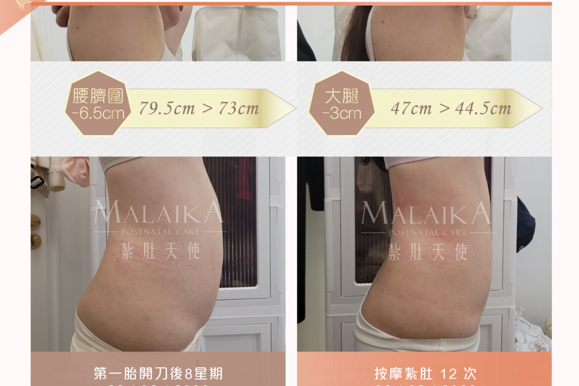 Malaika紮肚天使。產後紮肚及按摩