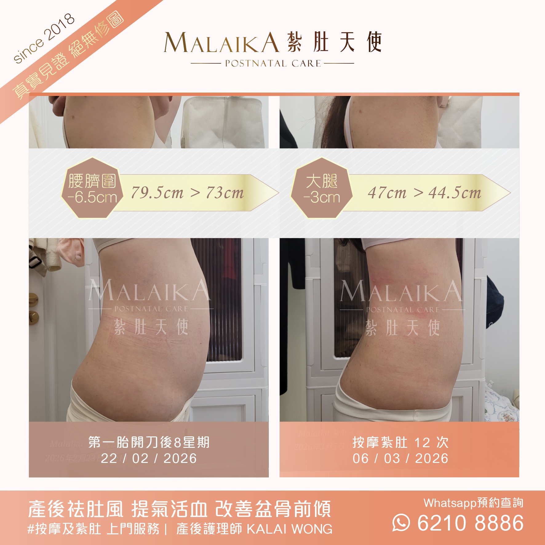 Malaika紮肚天使。產後紮肚及按摩