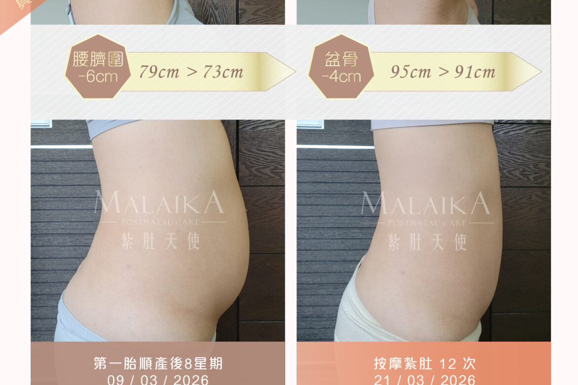 Malaika紮肚天使。產後紮肚及按摩