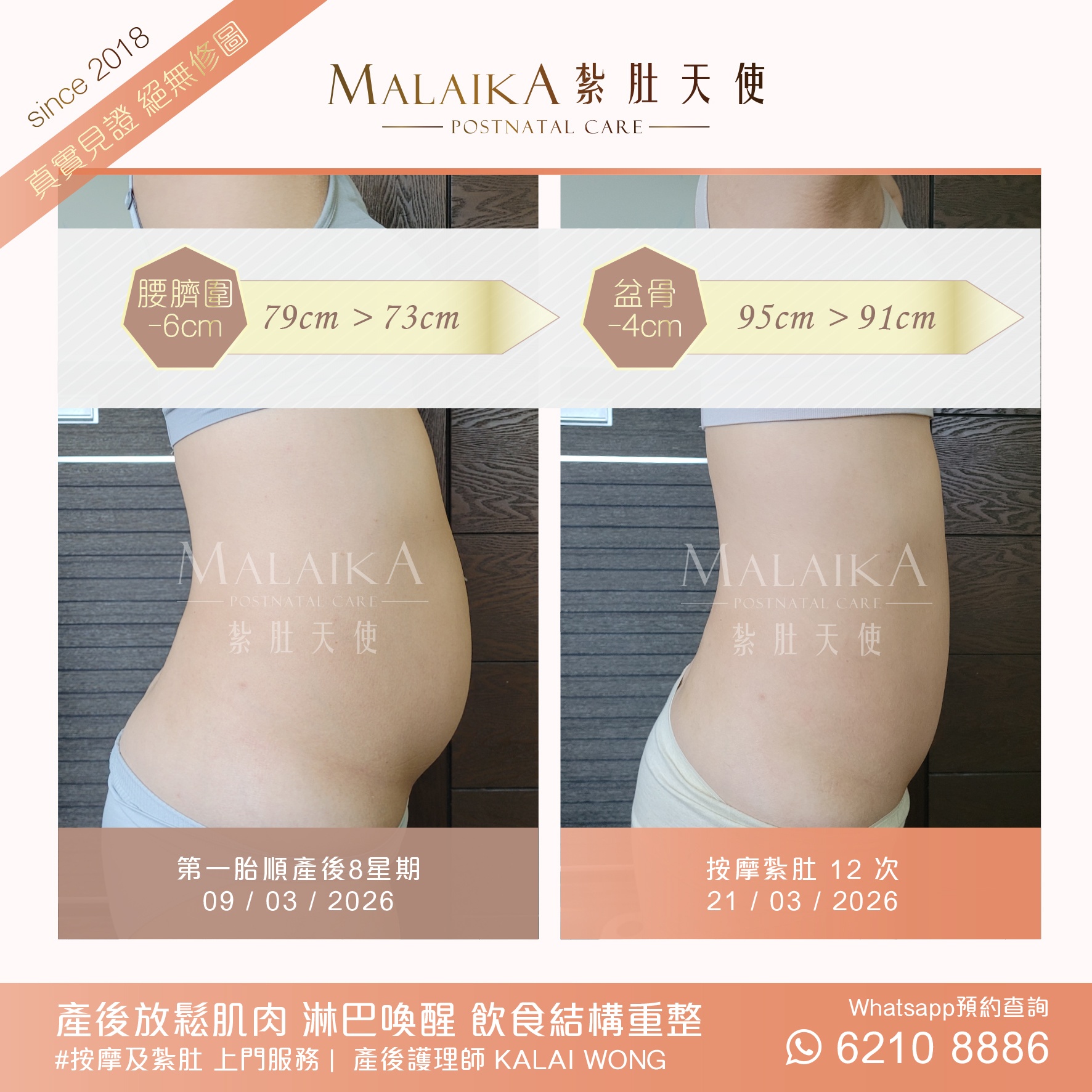 Malaika紮肚天使。產後紮肚及按摩