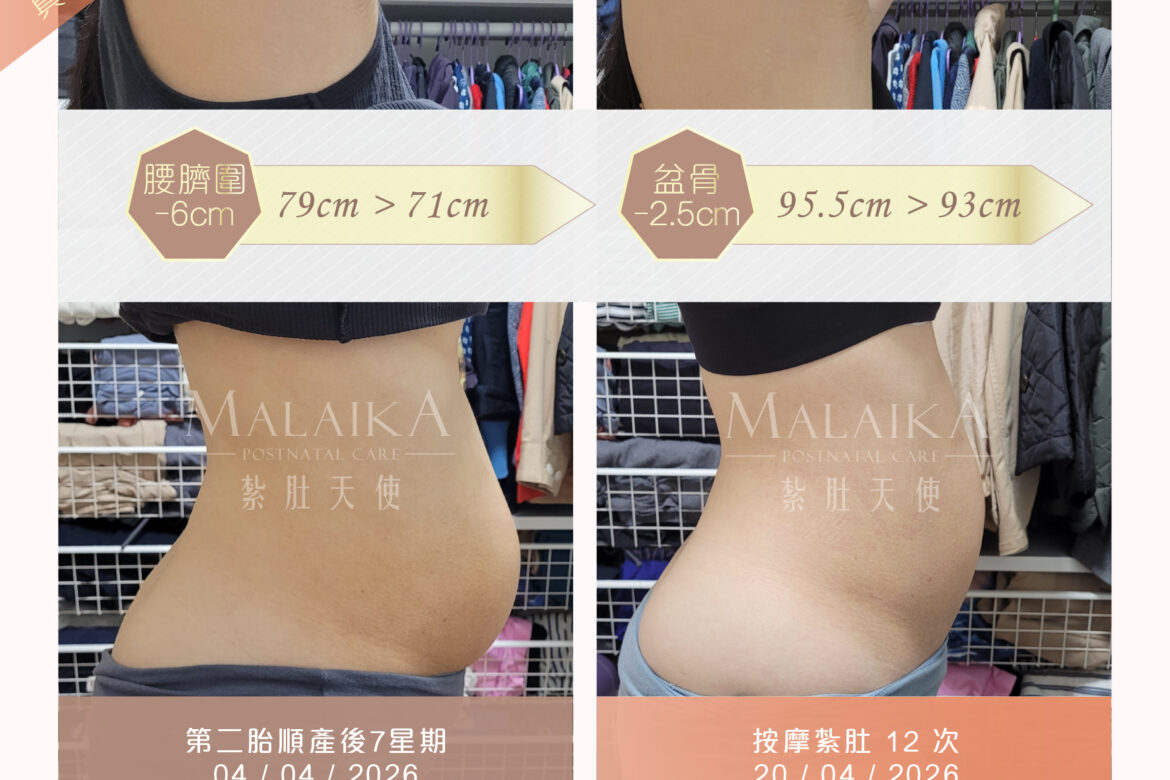 Malaika紮肚天使。產後紮肚及按摩