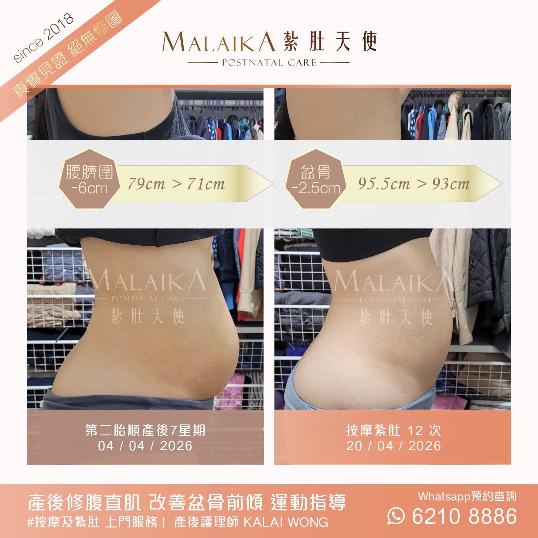 Malaika紮肚天使。產後紮肚及按摩