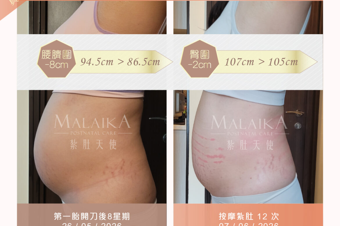 MALAIKA 紮肚天使