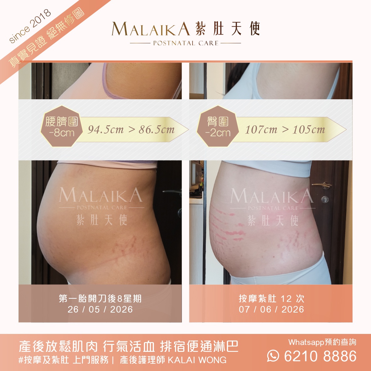 MALAIKA 紮肚天使