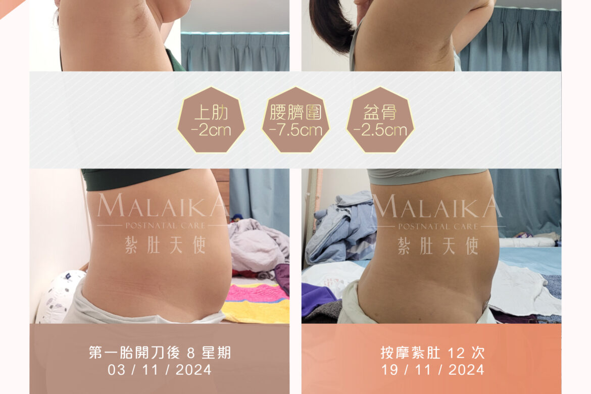 MALAIKA 紮肚天使