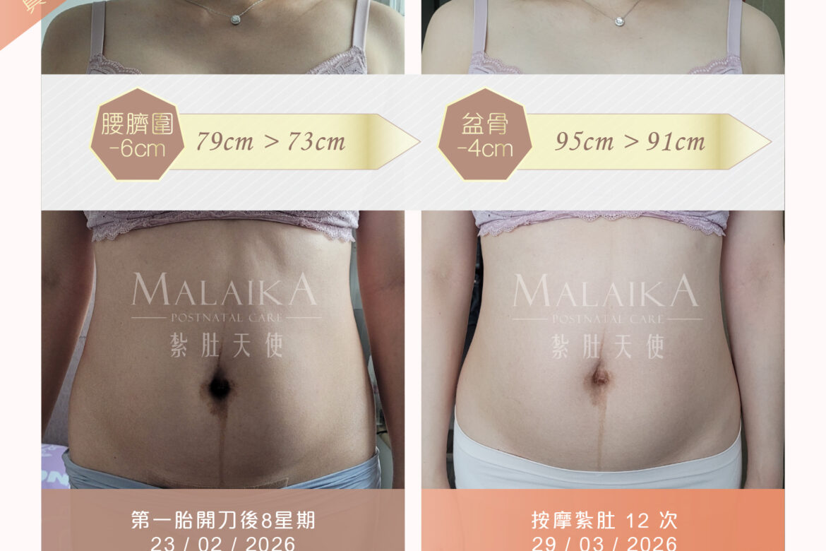 Malaika紮肚天使。產後紮肚及按摩