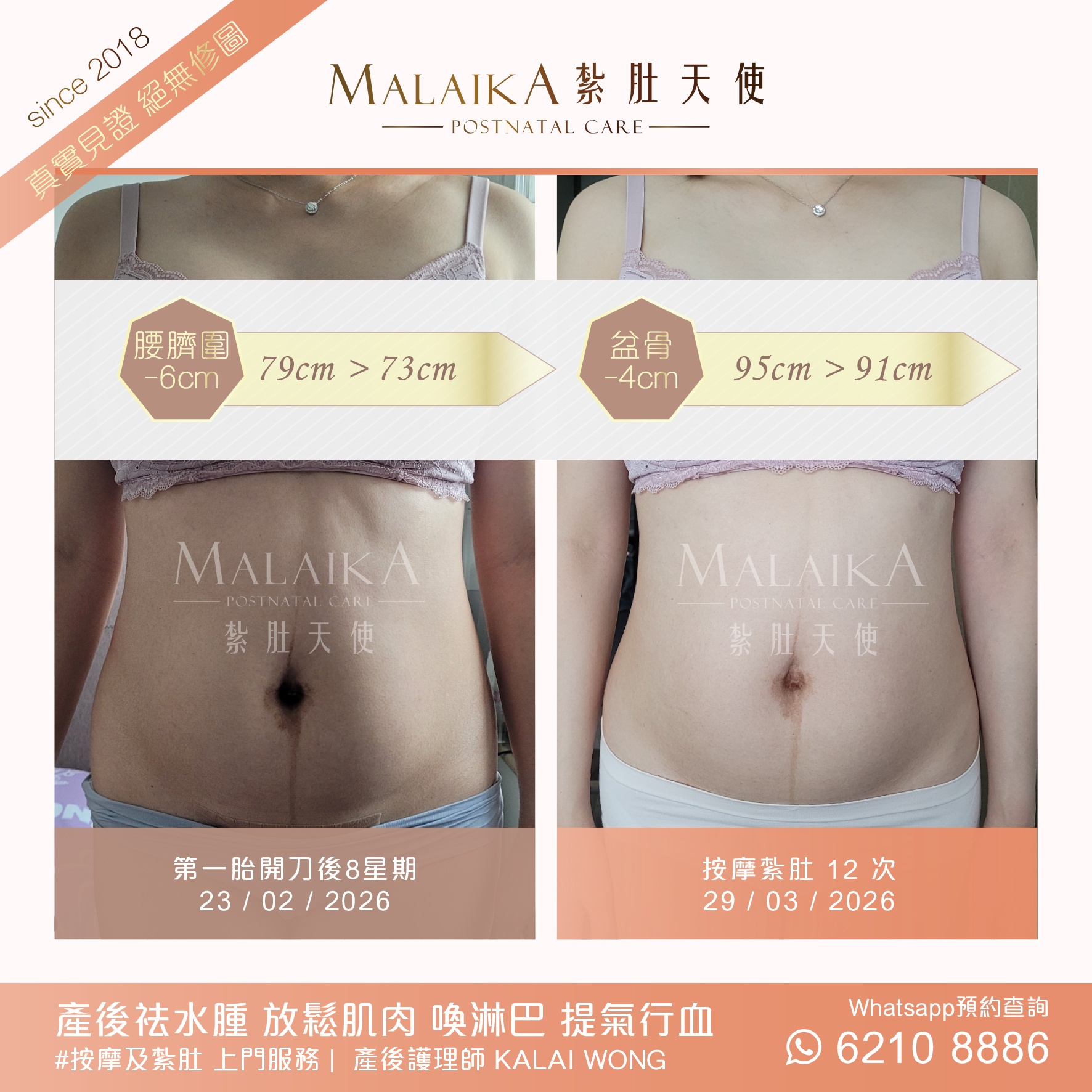 Malaika紮肚天使。產後紮肚及按摩
