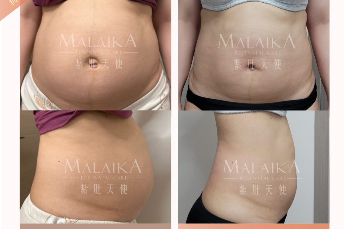 MALAIKA 紮肚天使