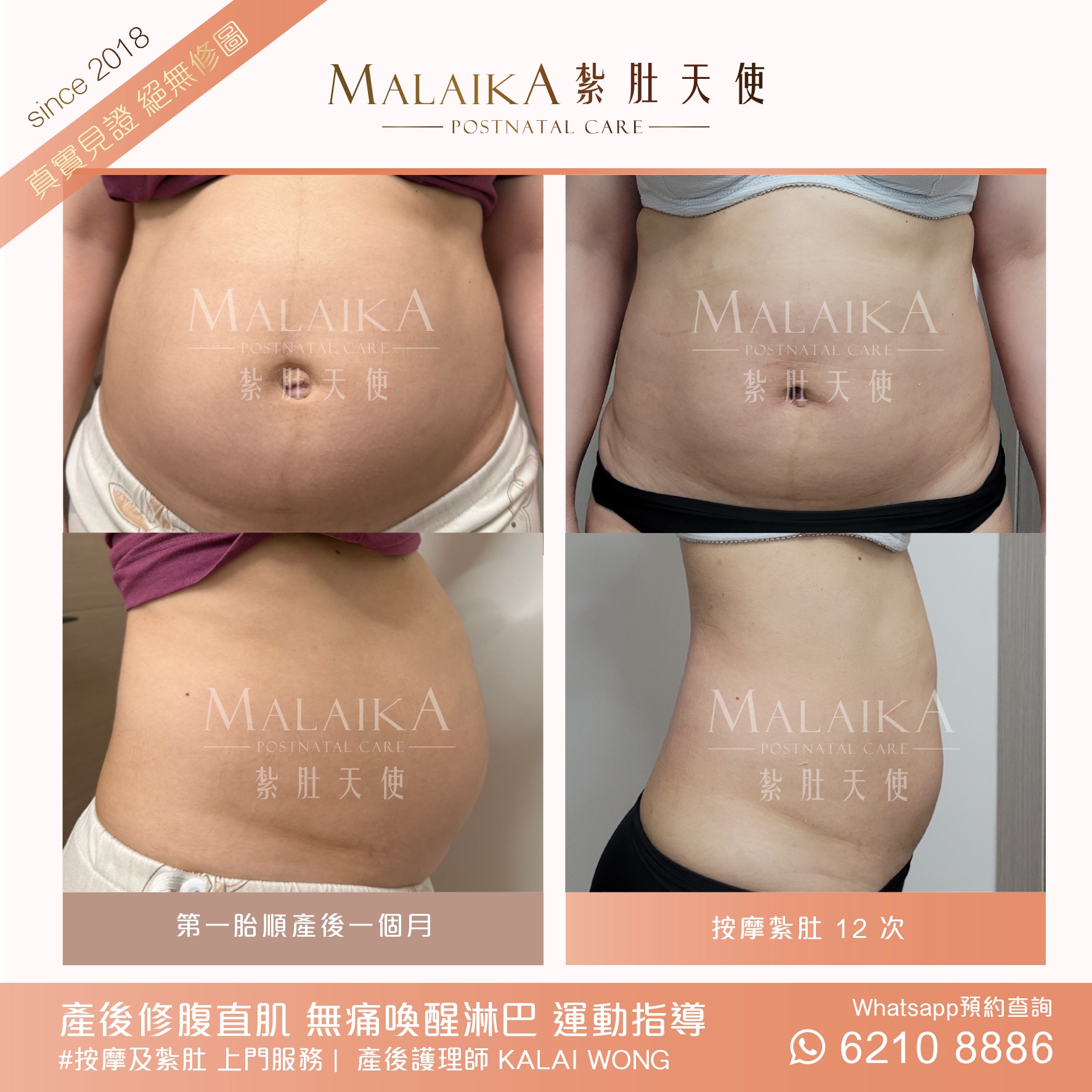 MALAIKA 紮肚天使