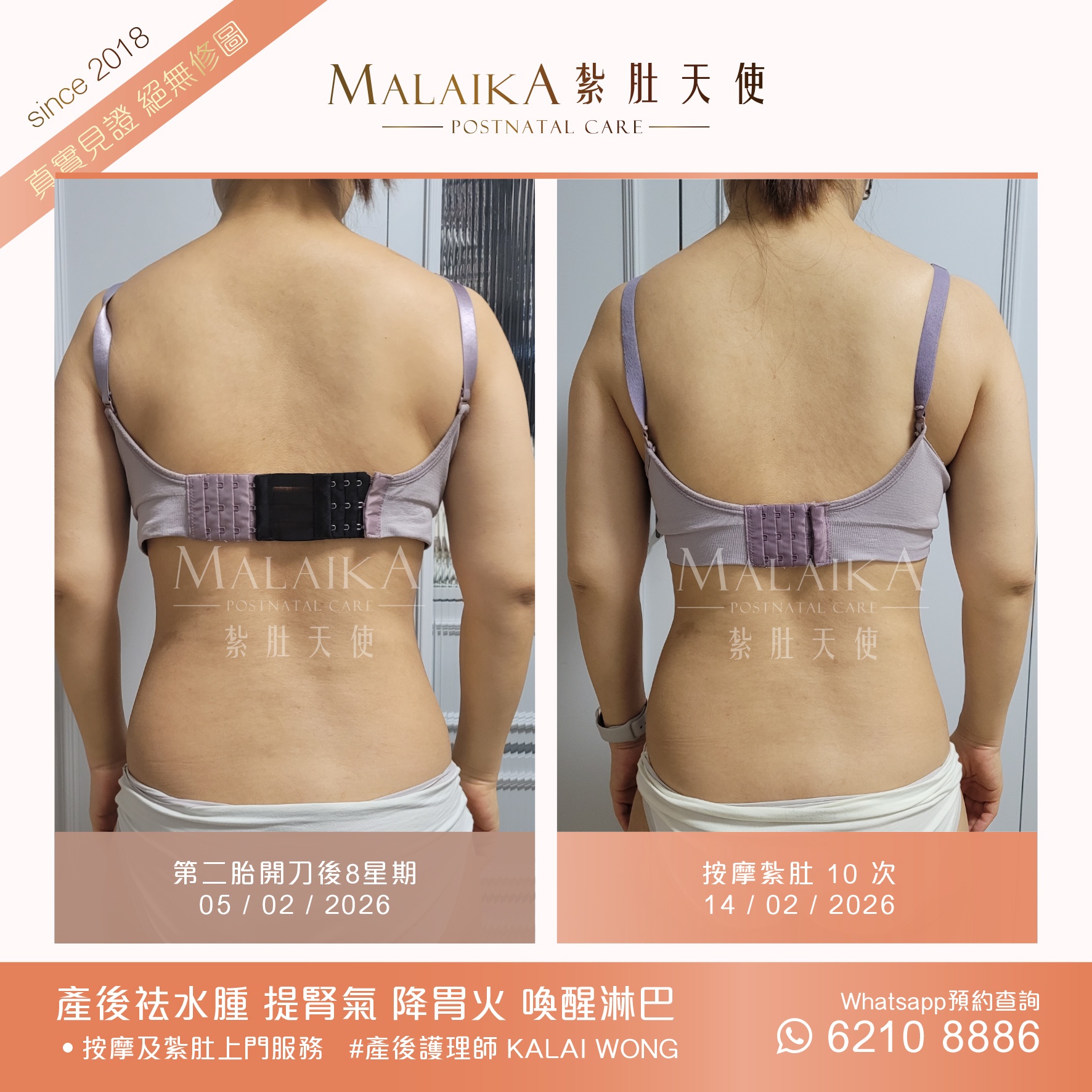 Malaika紮肚天使。產後紮肚及按摩